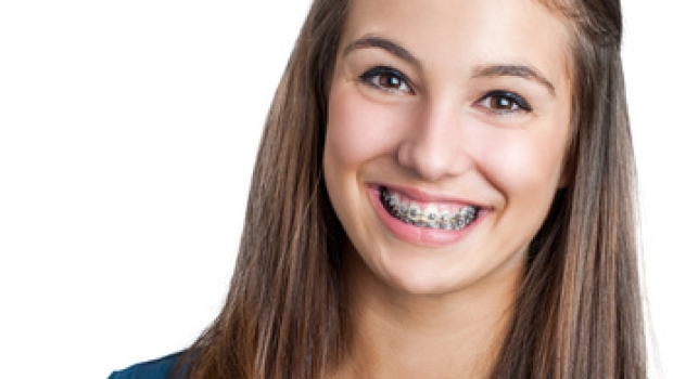 Zahnpflege beim Tragen einer Zahnspange